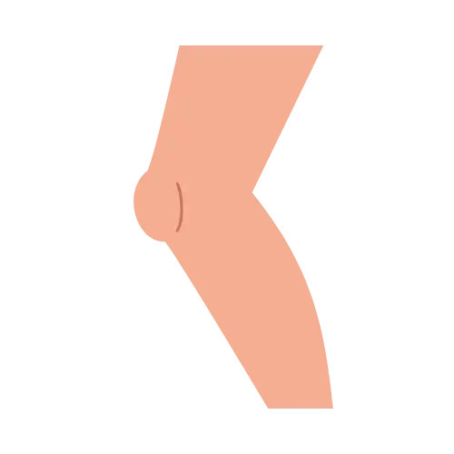 Leg/Foot illustration